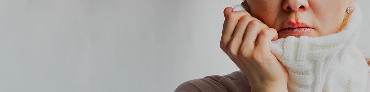 Understanding Cold Sore Causes and Treatment