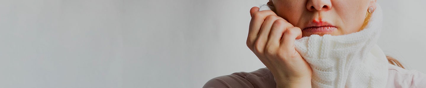 Understanding Cold Sore Causes and Treatment